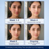 Proven Transformation Week by Week Visible clarity you can trust. Watch dark spots, texture, and pores improve progressively with consistent daily use.